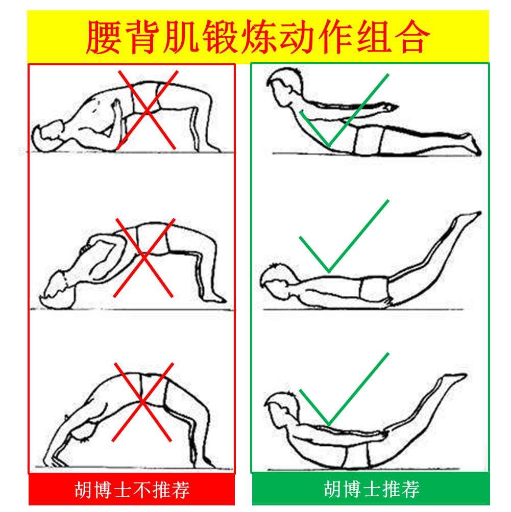 博士講堂:腰背肌鍛煉,你做對(duì)了嗎?(圖2)